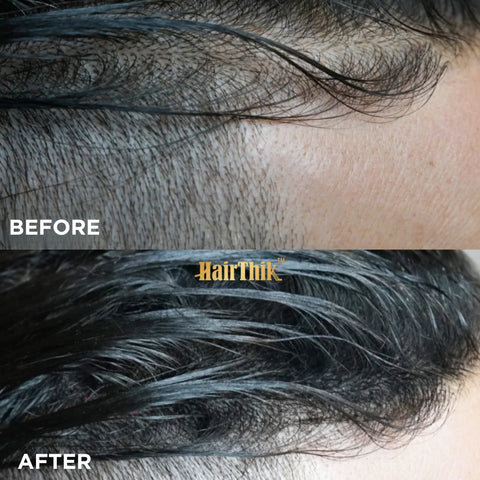 HairThik Dark Brown Hair Fibers - 15 Grams